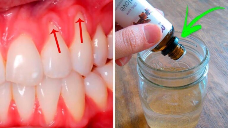 Cette astuce pour des gencives plus saines va transformer votre sourire… découvrez comment !