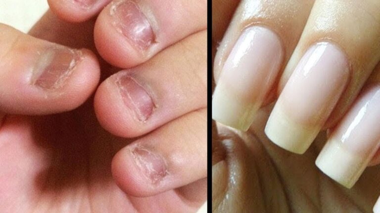 Ce simple geste pour des ongles longs et résistants… découvrez notre secret maison infaillible !