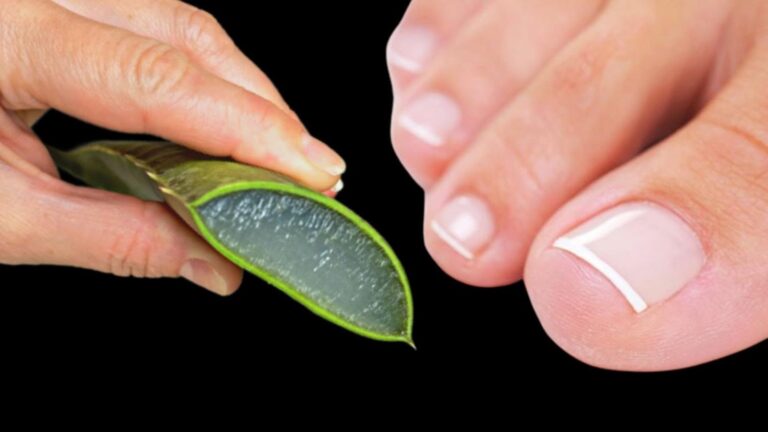Une idée toute simple pour dire adieu aux mycoses des ongles… découvrez vite l&rsquo;astuce !