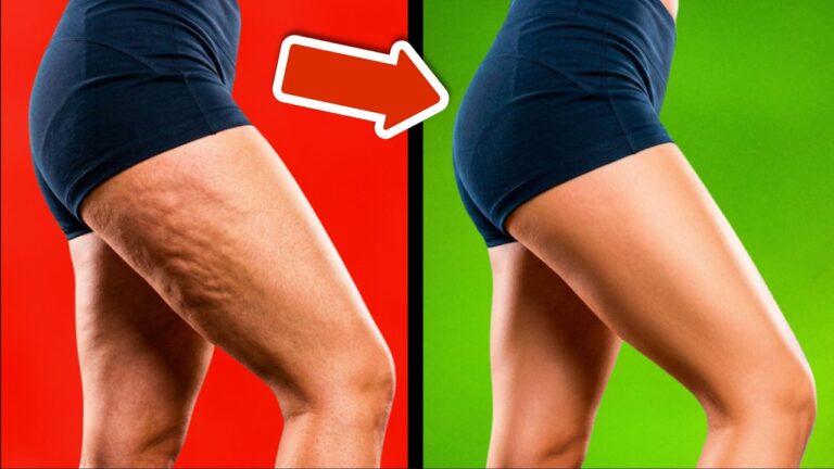 Éliminez 5 astuces efficaces contre la cellulite et les vergetures rapidement !