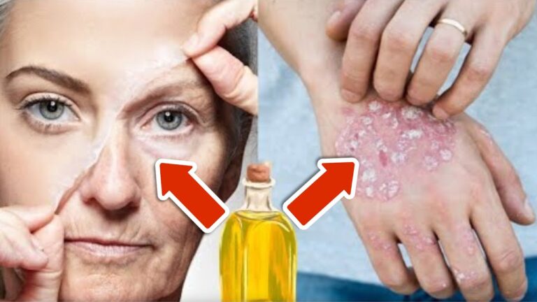 Réveillez votre peau : 5 astuces pour éliminer rides et sécheresse facilement !