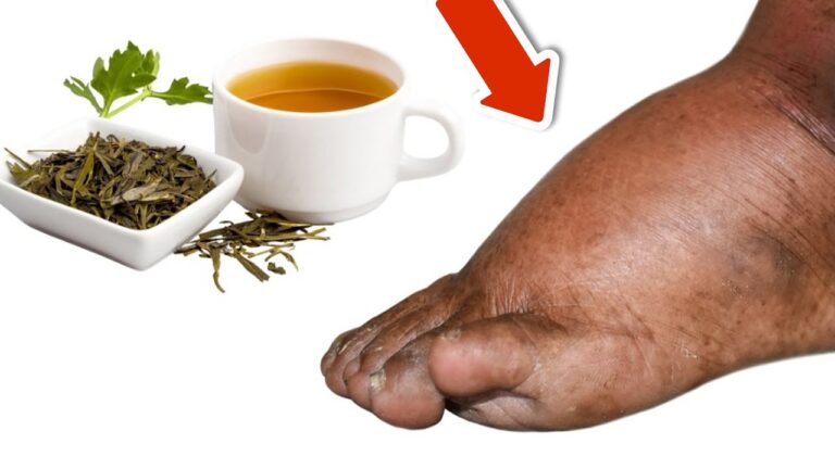 Dites adieu aux jambes enflées avec ce thé : 5 bienfaits à découvrir !