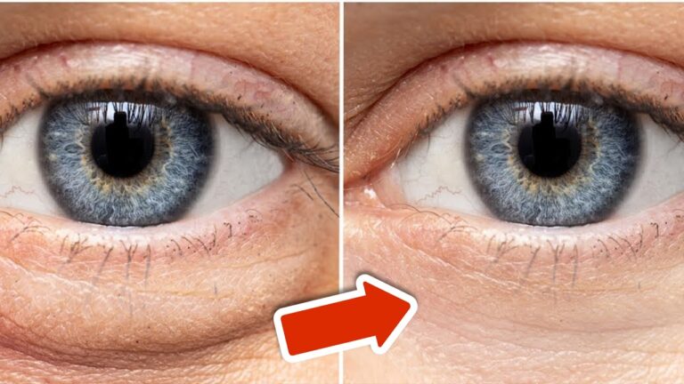 Éliminez vos yeux gonflés en 20 minutes avec ce simple astuce très efficace !