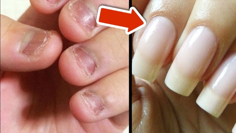 5 astuces pour avoir des ongles longs et sublimes en quelques jours !