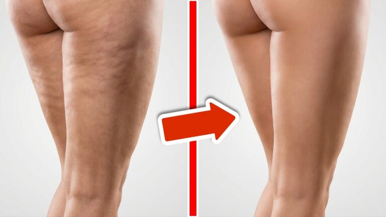 5 astuces infaillibles pour dire adieu à la cellulite rapidement et facilement !